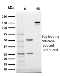 SDS-PAGE Analysis Purified StAR Mouse Monoclonal Antibody (STAR/2140).Confirmation of Integrity and Purity of Antibody.