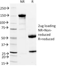 SDS-PAGE Analysis Purified StAR Mouse Monoclonal Antibody (STAR/2154).Confirmation of Integrity and Purity of Antibody.