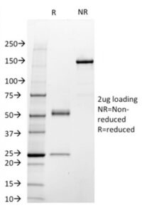 SDS-PAGE Analysis Purified STAT3 Mouse Monoclonal Antibody (STAT3/2409).Confirmation of Integrity and Purity of Antibody.