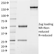 SDS-PAGE Analysis Purified TCF4 Mouse Monoclonal Antibody (TCF4/1705).Confirmation of Integrity and Purity of Antibody.