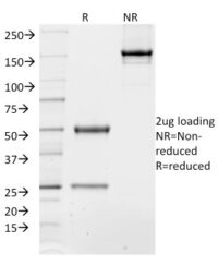 SDS-PAGE Analysis Purified TCF4 Mouse Monoclonal Antibody (TCF4/1705).Confirmation of Integrity and Purity of Antibody.