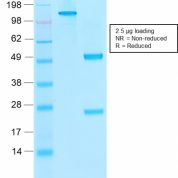 SDS-PAGE Analysis Purified Thrombomodulin Mouse Recombinant MAb (rTHBD/1591).Confirmation of Purity and Integrity of Antibody.