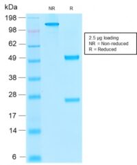 SDS-PAGE Analysis Purified Thrombomodulin Mouse Recombinant MAb (rTHBD/1591).Confirmation of Purity and Integrity of Antibody.