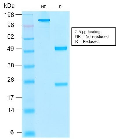SDS-PAGE Analysis Purified Thrombomodulin Mouse Recombinant MAb (rTHBD/1591).Confirmation of Purity and Integrity of Antibody.