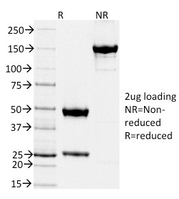 SDS-PAGE Analysis Purified TIMP2 Mouse Monoclonal Antibody (TIMP2/2044).Confirmation of Purity and Integrity of Antibody.
