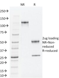 SDS-PAGE Analysis Purified TLE1 Mouse Monoclonal Antibody (TLE1/2062).Confirmation of Integrity and Purity of Antibody.