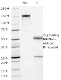 SDS-PAGE Analysis Purified p53 Mouse Monoclonal Antibody (PCRP-TP53-2A10).Confirmation of Integrity and Purity of Antibody.