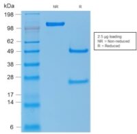 SDS-PAGE Analysis Purified p53 Mouse Recombinant Monoclonal Antibody (rTP53/1739).Confirmation of Purity and Integrity of Antibody.