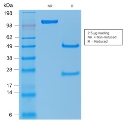 SDS-PAGE Analysis Purified p53 Mouse Recombinant Monoclonal Antibody (rTP53/1739).Confirmation of Purity and Integrity of Antibody.