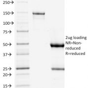 SDS-PAGE Analysis Purified p53 Mouse Monoclonal Antibody (TP53/1739).Confirmation of Purity and Integrity of Antibody.