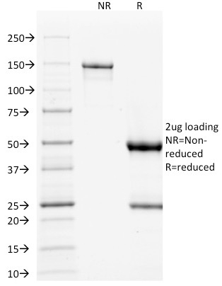 SDS-PAGE Analysis Purified p53 Mouse Monoclonal Antibody (TP53/1739).Confirmation of Purity and Integrity of Antibody.