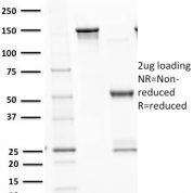 SDS PAGE Analysis  Purified p53 Recombinant Rabbit Monoclonal Antibody (TP53/1799R).Confirmation of Purity and Integrity.