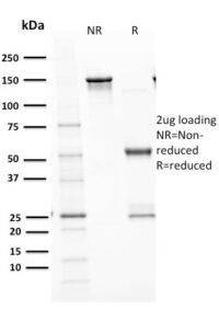 SDS PAGE Analysis  Purified p53 Recombinant Rabbit Monoclonal Antibody (TP53/1799R).Confirmation of Purity and Integrity.