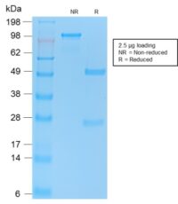 SDS-PAGE Analysis Purified p53 Recombinant Rabbit Monoclonal Antibody (TP53/2092R).Confirmation of Purity and Integrity.