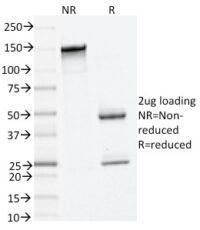 SDS-PAGE Analysis Purified Tryptase Mouse Monoclonal Antibody (TPSAB1/1961).Confirmation of Integrity and Purity of Antibody.