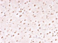 Formalin-fixed, paraffin-embedded human Brain stained with Ubiquitin Mouse Monoclonal Antibody (UBB/1748).