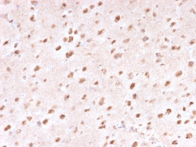 Formalin-fixed, paraffin-embedded human Brain stained with Ubiquitin Mouse Monoclonal Antibody (UBB/1748).