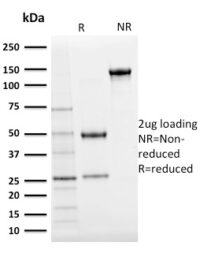 SDSPAGE Analysis Purified Ubiquitin Mouse Monoclonal Antibody (UBB/2122).Confirmation of purity and integrity.