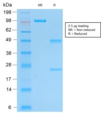 SDS-PAGE Analysis of Purified Pgp9.5 Mouse Recombinant Monoclonal Antibody (rUCHL1/775