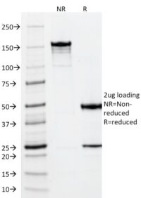 SDS-PAGE Analysis Purified Vimentin Mouse Monoclonal Antibody (VM452).Confirmation of Integrity and Purity of Antibody.