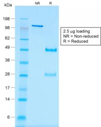 SDS-PAGE Analysis of Purified Wilms Tumor Mouse Recombinant Monoclonal Antibody (rWT1/857).