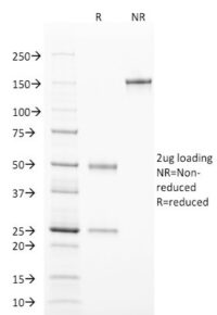 SDS-PAGE Analysis Purified TCL1 Mouse Monoclonal Antibody (TCL1/2078).Confirmation of Purity and Integrity of Antibody.