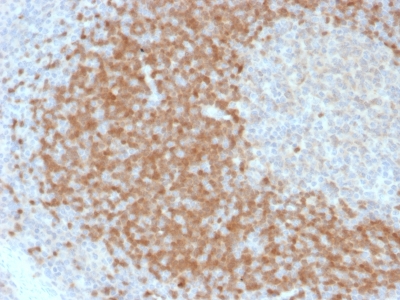 Formalin-fixed, paraffin-embedded human Tonsil stained with TCL1 Mouse Monoclonal Antibody (TCL1/2078).