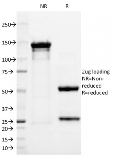 SDS-PAGE Analysis Purified p63 Mouse Monoclonal Antibody (TP63/2428).Confirmation of Integrity and Purity of Antibody.