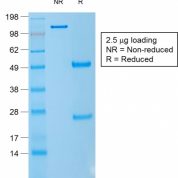 SDS-PAGE Analysis CD1a Mouse Recombinant Monoclonal Antibody (rC1A/711).Confirmation of Purity and Integrity of Antibody.