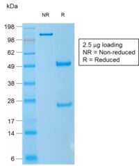 SDS-PAGE Analysis CD1a Mouse Recombinant Monoclonal Antibody (rC1A/711).Confirmation of Purity and Integrity of Antibody.