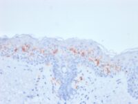 Formalin-fixed, paraffin-embedded human Skin Stained with CD1a Mouse Recombinant Monoclonal Antibody (rC1A/711).