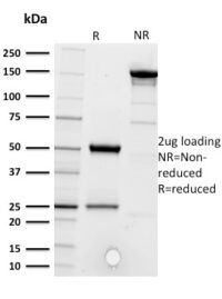 SDS-PAGE Analysis Purified CD5 Mouse Monoclonal Antibody (CD5/2416).Confirmation of Purity and Integrity of Antibody.