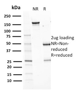 SDS-PAGE Analysis Purified Aurora B Mouse Monoclonal Antibody (AURKB/1593).Confirmation of Purity and Integrity of Antibody.