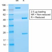 SDS-PAGE Analysis Purified CD8 Mouse Recombinant Monoclonal Antibody (rC8/468).Confirmation of Purity and Integrity of Antibody.