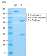 SDS-PAGE Analysis Purified CD8 Mouse Recombinant Monoclonal Antibody (rC8/468).Confirmation of Purity and Integrity of Antibody.