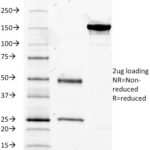 SDS-PAGE Analysis Purified CD14 Mouse Monoclonal Antibody (LPSR/2385). Confirmation of Integrity and Purity of Antibody.