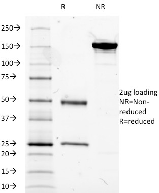 SDS-PAGE Analysis Purified CD14 Mouse Monoclonal Antibody (LPSR/2385). Confirmation of Integrity and Purity of Antibody.