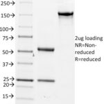 SDS-PAGE Analysis Purified CD14 Mouse Monoclonal Antibody (LPSR/2386).Confirmation of Integrity and Purity of Antibody.