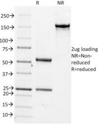 SDS-PAGE Analysis Purified CD14 Mouse Monoclonal Antibody (LPSR/2386).Confirmation of Integrity and Purity of Antibody.