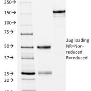 SDS-PAGE Analysis Purified CD14 Mouse Monoclonal Antibody (LPSR/2397).Confirmation of Integrity and Purity of Antibody.