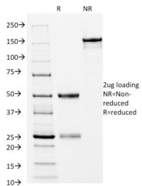 SDS-PAGE Analysis Purified CD14 Mouse Monoclonal Antibody (LPSR/2397).Confirmation of Integrity and Purity of Antibody.