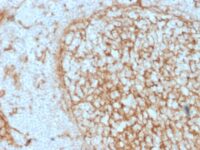 Formalin-fixed, paraffin-embedded human Tonsil stained with CD14 Mouse Monoclonal Antibody (LPSR/2397).