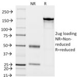 SDS-PAGE Analysis Purified CD14 Mouse Monoclonal Antibody (LPSR/2408).Confirmation of Integrity and Purity of Antibody.