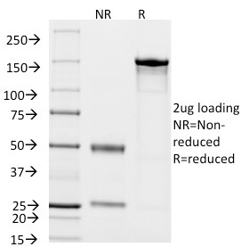 SDS-PAGE Analysis Purified CD14 Mouse Monoclonal Antibody (LPSR/2408).Confirmation of Integrity and Purity of Antibody.