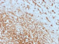 Formalin-fixed, paraffin-embedded human Tonsil Stained with CD14 Mouse Monoclonal Antibody (LPSR/2408).