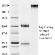SDS-PAGE Analysis Purified CD163 Mouse Monoclonal Antibody (M130/1210).Confirmation of Integrity and Purity of Antibody.