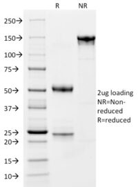 SDS-PAGE Analysis Purified CD163 Mouse Monoclonal Antibody (M130/1210).Confirmation of Integrity and Purity of Antibody.