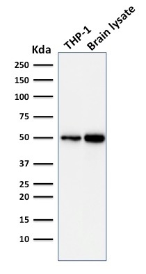Western Blot Analysis of THP-1 Cell and human Brain Tissue Lysate using ATG5 Mouse Monoclonal Antibody (ATG5/2101).