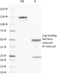 SDS-PAGE Analysis Purified CD40 Mouse Monoclonal Antibody (C40/2383).Confirmation of Integrity and Purity of Antibody.