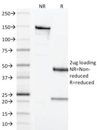 SDS-PAGE Analysis Purified CD68 Mouse Monoclonal Antibody (LAMP4/1830).Confirmation of Integrity and Purity of Antibody.